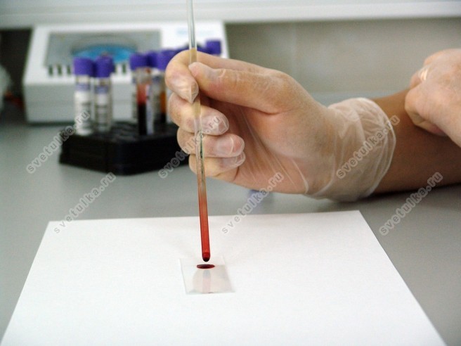 Как определить вирусное заболевание по анализу крови thumbnail